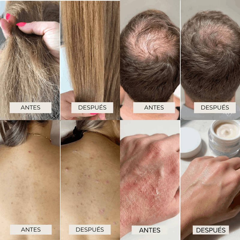 Cabezal de Ducha Aqualo® con Filtro Antisarro