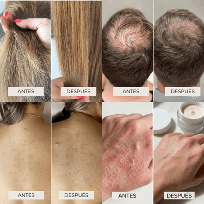 Cabezal de Ducha Aqualo® con Filtro Antisarro