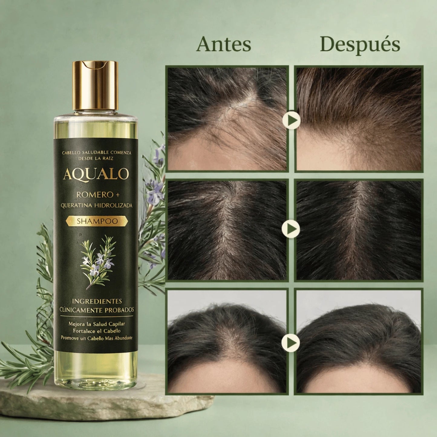 AQUALO™ Shampoo Anticaída y Crecimiento