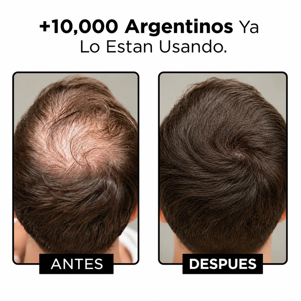 AQUALO™ Shampoo Anticaída y Crecimiento