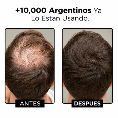AQUALO™ Shampoo Anticaída y Crecimiento